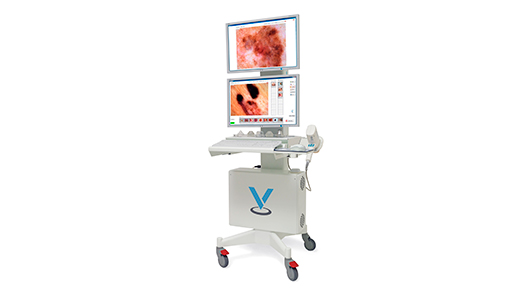 dermatoscopio digital Vidix