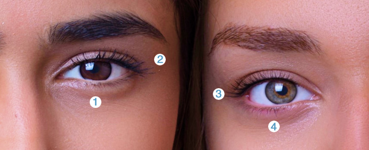 dc3 tratamiento_ojeras